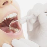 あなたの印象を変える審美歯科の治療方法５選