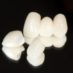 審美歯科の治療で使用される素材について